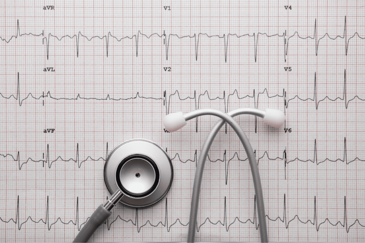 Electrocardiogram
